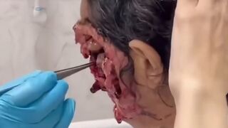 Woman with horrific Infection