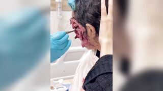 Woman with horrific Infection