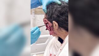 Woman with horrific Infection