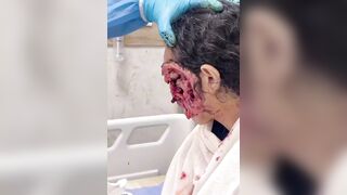 Woman with horrific Infection