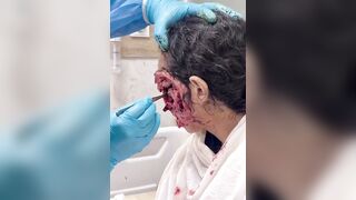 Woman with horrific Infection