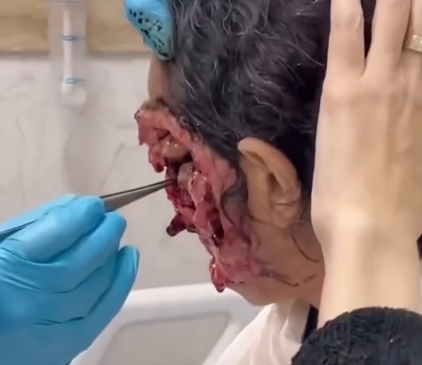 Woman with horrific Infection