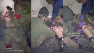 A wounded russian invader undergoes an arm amputation performed with a knife