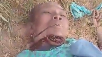 Rapist Left Poor Woman With A Throat Slit