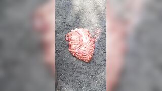 Brain Ejected From Suicide Jumper Who Was Rejected By Whore