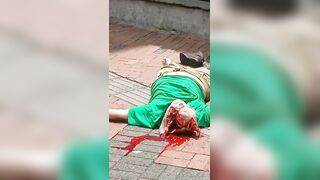 Brain Ejected From Suicide Jumper Who Was Rejected By Whore