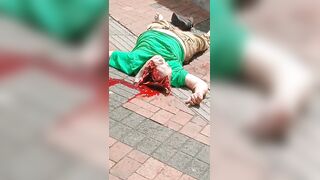 Brain Ejected From Suicide Jumper Who Was Rejected By Whore