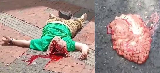 Brain Ejected From Suicide Jumper Who Was Rejected By Whore