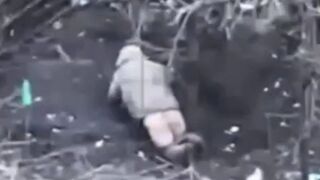 Ukrainian experiences extreme anal prolapse.