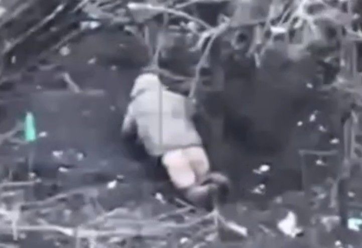 Ukrainian experiences extreme anal prolapse.