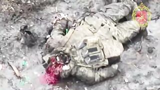 Low-budget cranial surgery on a Ukrainian.