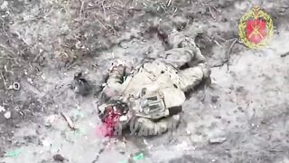 Low-budget cranial surgery on a Ukrainian.