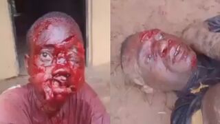 Woman Attacked With Machete During Land Dispute