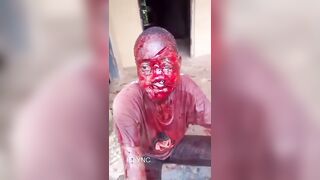 Woman Attacked With Machete During Land Dispute