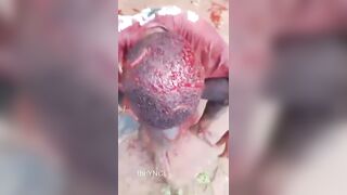 Woman Attacked With Machete During Land Dispute