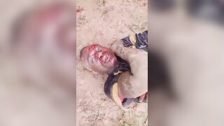 Woman Attacked With Machete During Land Dispute