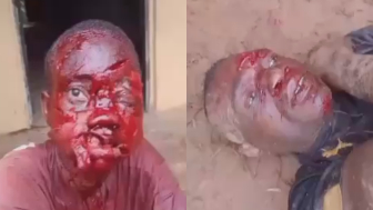 Woman Attacked With Machete During Land Dispute