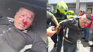 Attempted Vehicle Theft Gone Wrong In Colombia