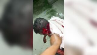 Man Literally Falls Apart After Machete Attack