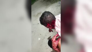 Man Literally Falls Apart After Machete Attack