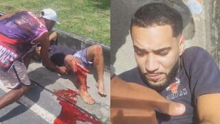 It Will Take Time For Him To Recover