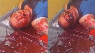 Man Shot In Stomach Vomits Blood In Terrible Agony in Slums