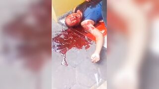 Man Shot In Stomach Vomits Blood In Terrible Agony in Slums