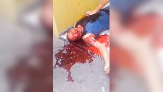 Man Shot In Stomach Vomits Blood In Terrible Agony in Slums