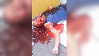 Man Shot In Stomach Vomits Blood In Terrible Agony in Slums