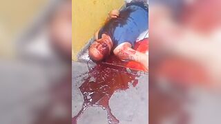 Man Shot In Stomach Vomits Blood In Terrible Agony in Slums