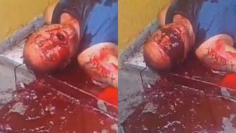 Man Shot In Stomach Vomits Blood In Terrible Agony in Slums