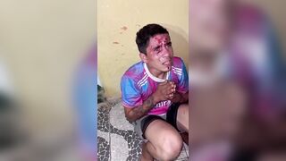 Thief Gets Beaten With A Chain, Kicked By Angry Man