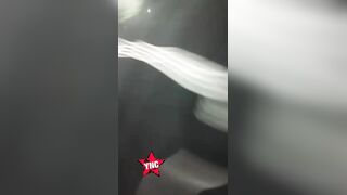 Woman Scalped After Serious Motorcycle Accident