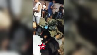 Woman Scalped After Serious Motorcycle Accident
