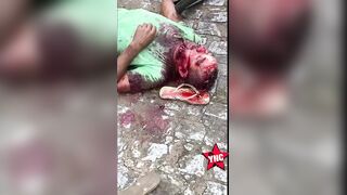 Man Chilling With Friends Attacked, Killed With A Sickle In Brazil
