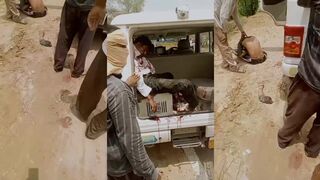Arm severed in road accident