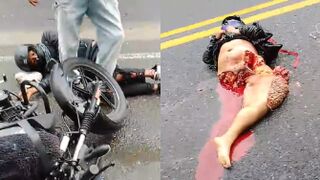 Motorcycle Accident In Colombia Leaves Woman Dismembered And Her BF In Critical Condition
