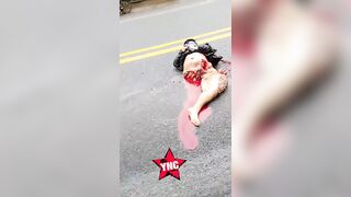 Motorcycle Accident In Colombia Leaves Woman Dismembered And Her BF In Critical Condition