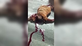 Closed Casked Case: Brazilian Woman`s Head Destroyed By The Bus