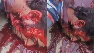 Protester In Kashmir Dies In Horrible Agony After Being Shot By Paramilitary Group