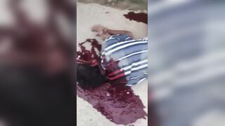 Protester In Kashmir Dies In Horrible Agony After Being Shot By Paramilitary Group