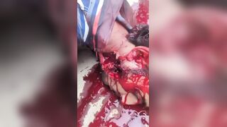 Protester In Kashmir Dies In Horrible Agony After Being Shot By Paramilitary Group