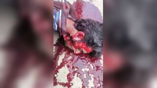 Protester In Kashmir Dies In Horrible Agony After Being Shot By Paramilitary Group