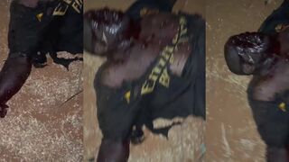 Man wounded in explosion