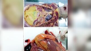 gore compilation