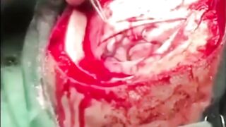 gore compilation