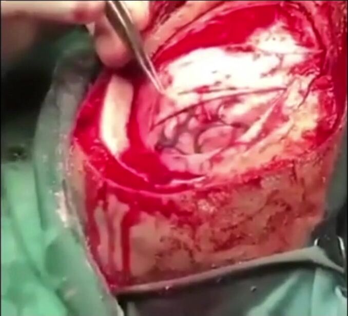 Gore Compilation 53