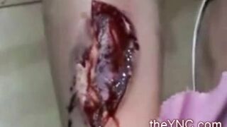 Classic: Fireworks explode during wedding and injures bride