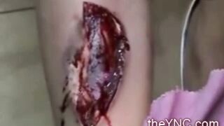 Classic: Fireworks explode during wedding and injures bride