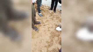 Elderly Man Got Bone Exposed After A  Tractor Accident
